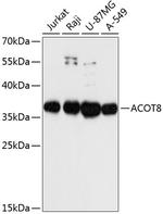 ACOT8 Antibody in Western Blot (WB)