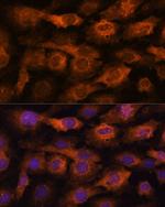 IFITM3 Antibody in Immunocytochemistry (ICC/IF)