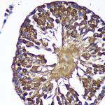 SENP1 Antibody in Immunohistochemistry (Paraffin) (IHC (P))