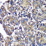 SENP1 Antibody in Immunohistochemistry (Paraffin) (IHC (P))