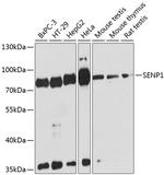 SENP1 Antibody in Western Blot (WB)