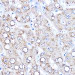 AADAT Antibody in Immunohistochemistry (Paraffin) (IHC (P))