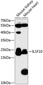 IL1F10 Antibody in Western Blot (WB)