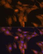 TSLP Antibody in Immunocytochemistry (ICC/IF)