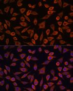 TSLP Antibody in Immunocytochemistry (ICC/IF)