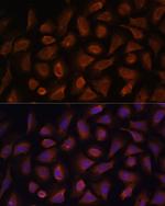 TSLP Antibody in Immunocytochemistry (ICC/IF)