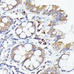 IL-1 alpha Antibody in Immunohistochemistry (Paraffin) (IHC (P))