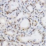 PER2 Antibody in Immunohistochemistry (Paraffin) (IHC (P))