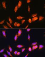 SCYL2 Antibody in Immunocytochemistry (ICC/IF)