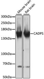 CAPS1 Antibody in Western Blot (WB)