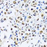 OTP Antibody in Immunohistochemistry (Paraffin) (IHC (P))