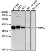 RBM11 Antibody in Western Blot (WB)