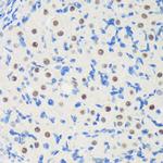 LARP2 Antibody in Immunohistochemistry (Paraffin) (IHC (P))