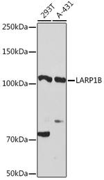 LARP2 Antibody in Western Blot (WB)