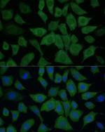 IDH1 Antibody in Immunocytochemistry (ICC/IF)