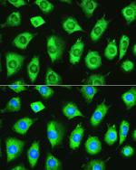 YTHDF1 Antibody in Immunocytochemistry (ICC/IF)