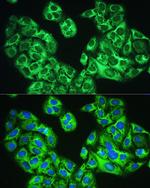 YTHDF1 Antibody in Immunocytochemistry (ICC/IF)