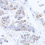 ACAT1 Antibody in Immunohistochemistry (Paraffin) (IHC (P))