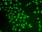 CRY2 Antibody in Immunocytochemistry (ICC/IF)