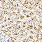 Cathepsin D Antibody in Immunohistochemistry (Paraffin) (IHC (P))