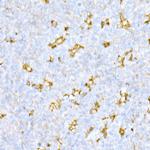 Cathepsin D Antibody in Immunohistochemistry (Paraffin) (IHC (P))