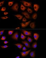 DBI Antibody in Immunocytochemistry (ICC/IF)