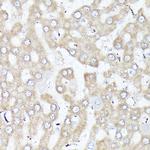 DBI Antibody in Immunohistochemistry (Paraffin) (IHC (P))