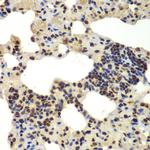 DDX5 Antibody in Immunohistochemistry (Paraffin) (IHC (P))