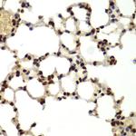 DDX5 Antibody in Immunohistochemistry (Paraffin) (IHC (P))