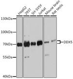 DDX5 Antibody in Western Blot (WB)