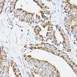 DLD Antibody in Immunohistochemistry (Paraffin) (IHC (P))