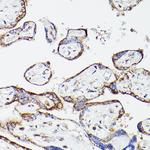 DLD Antibody in Immunohistochemistry (Paraffin) (IHC (P))