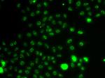 ETV1 Antibody in Immunocytochemistry (ICC/IF)