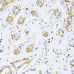 ETV1 Antibody in Immunohistochemistry (Paraffin) (IHC (P))