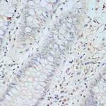 TCEB2 Antibody in Immunohistochemistry (Paraffin) (IHC (P))