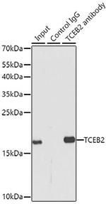 TCEB2 Antibody in Immunoprecipitation (IP)