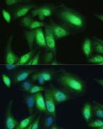 VCP Antibody in Immunocytochemistry (ICC/IF)