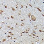 VCP Antibody in Immunohistochemistry (Paraffin) (IHC (P))