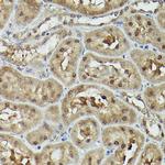 VCP Antibody in Immunohistochemistry (Paraffin) (IHC (P))