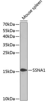 SSNA1 Antibody in Western Blot (WB)