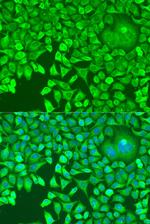 PUM1 Antibody in Immunocytochemistry (ICC/IF)