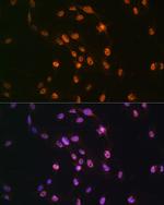 TDP-43 Antibody in Immunocytochemistry (ICC/IF)