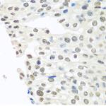 TDP-43 Antibody in Immunohistochemistry (Paraffin) (IHC (P))