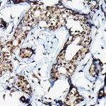 SUFU Antibody in Immunohistochemistry (Paraffin) (IHC (P))