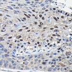 SUFU Antibody in Immunohistochemistry (Paraffin) (IHC (P))