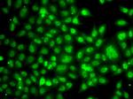 TBLR1 Antibody in Immunocytochemistry (ICC/IF)