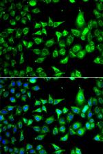 ACCS Antibody in Immunocytochemistry (ICC/IF)