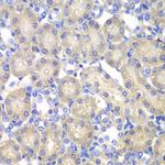 Aminoacylase Antibody in Immunohistochemistry (Paraffin) (IHC (P))