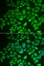 EHHADH Antibody in Immunocytochemistry (ICC/IF)