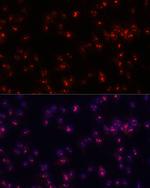 Fibrillarin Antibody in Immunocytochemistry (ICC/IF)